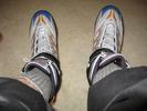 my feet rollerblades